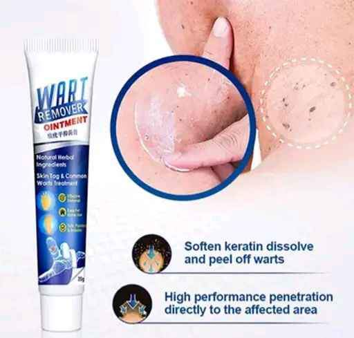 Crème Anti Verrues